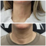 WhatsApp Image 2025-08-13 at 19.51.28